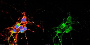 Anti-MAP-2 Antibody from rabbit, purified by affinity chromatography