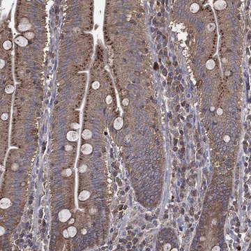 Anti-Pdcd6Ip Antibody Produced In Rabbit Prestige Antibodies® Powered by Atlas Antibodies, affinity isolated antibody, buffered aqueous glycerol solution