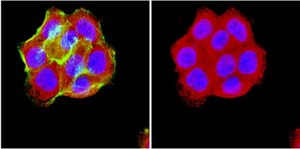 Anti-Opioid Receptor Antibody, µ, pain serum, Chemicon®