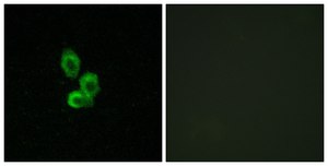 Anti-PDGF Receptor β antibody produced in rabbit affinity isolated antibody