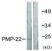 Anti-PMP22 antibody produced in rabbit affinity isolated antibody