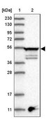 Anti-TUBE1 antibody produced in rabbit Prestige Antibodies® Powered by Atlas Antibodies, affinity isolated antibody, buffered aqueous glycerol solution, ab1