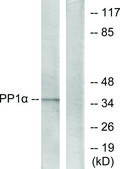 Anti-PP1-α antibody produced in rabbit affinity isolated antibody