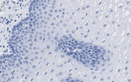 Anti-Involucrin Antibody, clone 1D13 ZooMAb® Rabbit Monoclonal recombinant, expressed in HEK 293 cells