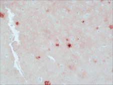 抗β-淀粉样抗体，小鼠单克隆 小鼠抗 clone BAM-10, ascites fluid