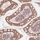 Anti-TOMM70 antibody produced in rabbit Prestige Antibodies® Powered by Atlas Antibodies, affinity isolated antibody, buffered aqueous glycerol solution