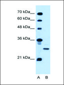 Anti-PDPN antibody produced in rabbit affinity isolated antibody