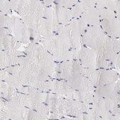 Anti-RNASE1 antibody produced in rabbit Prestige Antibodies® Powered by Atlas Antibodies, affinity isolated antibody, buffered aqueous glycerol solution
