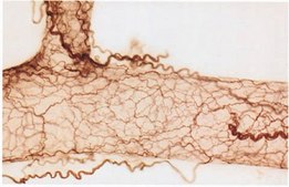 Anti-Nerve Growth Factor Receptor Antibody, extracellular, clone 192-IgG clone 192-IgG, Chemicon®, from mouse