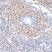 Anti-Phospho-AKT1S1-T246 antibody produced in rabbit