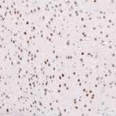 Monoclonal Anti-TCF7L2 antibody produced in mouse Prestige Antibodies® Powered by Atlas Antibodies, clone CL11547, purified antibody (Protein A)