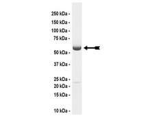 TGFBR-1 Protein, active, 10 µg Active, N-terminal GST-tagged, recombinant, human TGFBR1 amino acids 200–end containing a T204D mutation, expressed by baculovirus in Sf21 insect cells. Purified using glutathione agarose. For use in Kinase Assays.