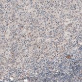 Monoclonal Anti-CDK5RAP2 antibody produced in mouse Prestige Antibodies® Powered by Atlas Antibodies, clone CL3392, purified immunoglobulin