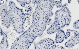 Anti-ATF6α Antibody, clone 1F11 ZooMAb® Rabbit Monoclonal recombinant, expressed in HEK 293 cells