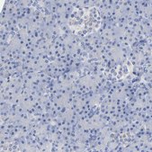 Anti-PLP1 antibody produced in rabbit Prestige Antibodies® Powered by Atlas Antibodies, affinity isolated antibody, buffered aqueous glycerol solution