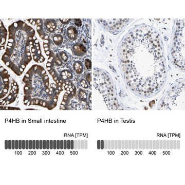 Anti-P4HB antibody produced in rabbit Prestige Antibodies® Powered by Atlas Antibodies, affinity isolated antibody, buffered aqueous glycerol solution