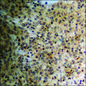 抗-磷酸-PPAR-γ (pSer112) 兔抗 affinity isolated antibody
