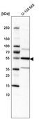 Anti-IL1R1 antibody produced in rabbit Prestige Antibodies® Powered by Atlas Antibodies, affinity isolated antibody, buffered aqueous glycerol solution