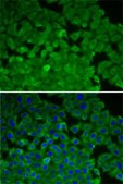 Anti-EEF2K antibody produced in rabbit