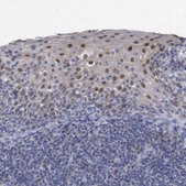 Anti-ZNF750 antibody produced in rabbit Prestige Antibodies® Powered by Atlas Antibodies, affinity isolated antibody, buffered aqueous glycerol solution, Ab2