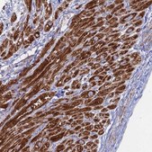 Anti-MPC1 antibody produced in rabbit Prestige Antibodies® Powered by Atlas Antibodies, affinity isolated antibody, buffered aqueous glycerol solution