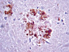 Anti-APP A4 Antibody, a.a. 66-81 of APP {NT}, clone 22C11 clone 22C11, Chemicon®, from mouse