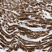 Anti-DES antibody produced in rabbit Prestige Antibodies® Powered by Atlas Antibodies, affinity isolated antibody, buffered aqueous glycerol solution