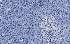 Anti-O-GlcNAc Transferase Antibody, clone 1O19 ZooMAb® Rabbit Monoclonal recombinant, expressed in HEK 293 cells