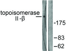Anti-TOP2B antibody produced in rabbit affinity isolated antibody