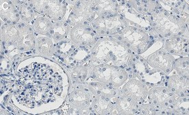 Anti-Aconitase 2/ACO2 Antibody, clone 1D15 ZooMAb® Rabbit Monoclonal recombinant, expressed in HEK 293 cells