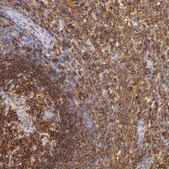 Anti-LYN antibody produced in rabbit Prestige Antibodies® Powered by Atlas Antibodies, affinity isolated antibody, buffered aqueous glycerol solution