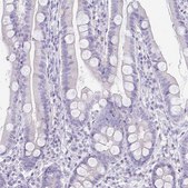 Anti-PAX5 antibody produced in rabbit Prestige Antibodies® Powered by Atlas Antibodies, affinity isolated antibody, buffered aqueous glycerol solution