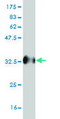 Monoclonal Anti-UBQLN2 antibody produced in mouse clone 5F5, purified immunoglobulin, buffered aqueous solution