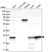 Anti-MGMT antibody produced in rabbit Prestige Antibodies® Powered by Atlas Antibodies, affinity isolated antibody