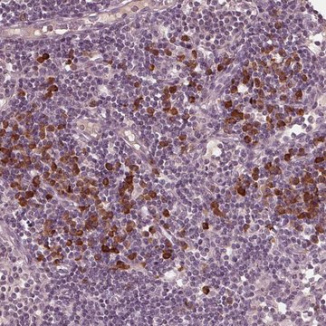 Anti-CXCL16 antibody produced in rabbit Prestige Antibodies® Powered by Atlas Antibodies, affinity isolated antibody, buffered aqueous glycerol solution