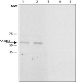 Anti-Calsequestrin-2 兔抗 ~1.0 mg/mL, affinity isolated antibody, buffered aqueous solution