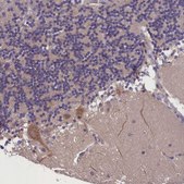 Anti-ABCC8 antibody produced in rabbit Prestige Antibodies® Powered by Atlas Antibodies, affinity isolated antibody, buffered aqueous glycerol solution