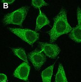 Anti-eIF-2α Antibody, clone 3M6 ZooMAb® Rabbit Monoclonal recombinant, expressed in HEK 293 cells