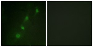 Anti-SGK antibody produced in rabbit affinity isolated antibody