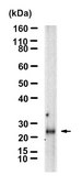 Anti-IL-5 Antibody, clone 1B20 ZooMAb® Rabbit Monoclonal recombinant, expressed in HEK 293 cells