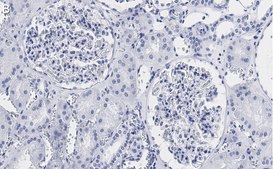 Anti-Vimentin Antibody, clone 2I13 ZooMAb® Rabbit Monoclonal recombinant, expressed in HEK 293 cells