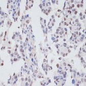 Anti-Phospho-SRF-S103 antibody produced in rabbit