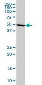 Monoclonal Anti-IMPDH1 antibody produced in mouse clone 3G6, purified immunoglobulin, buffered aqueous solution