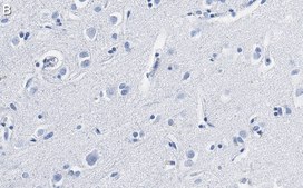 Anti-BDNF Antibody, clone 1I14 ZooMAb® Rabbit Monoclonal recombinant, expressed in HEK 293 cells