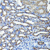 Anti- TTC11/FIS1 antibody produced in rabbit