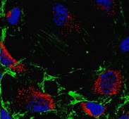 Anti-alpha-Actin Antibody, Smooth Muscle from rabbit, purified by affinity chromatography