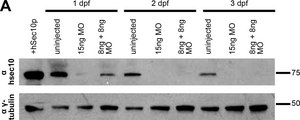 Anti-γ-Tubulin antibody produced in rabbit affinity isolated antibody, buffered aqueous solution