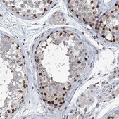 Anti-BMI1 antibody produced in rabbit Prestige Antibodies® Powered by Atlas Antibodies, affinity isolated antibody, buffered aqueous glycerol solution