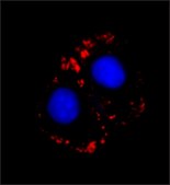 单克隆抗肌球蛋白（骨骼肌快肌） 小鼠抗 clone MY-32, ascites fluid