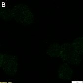 Anti-p-ZAP-70 (Tyr493) Antibody, clone 1F10 ZooMAb® Rabbit Monoclonal recombinant, expressed in HEK 293 cells